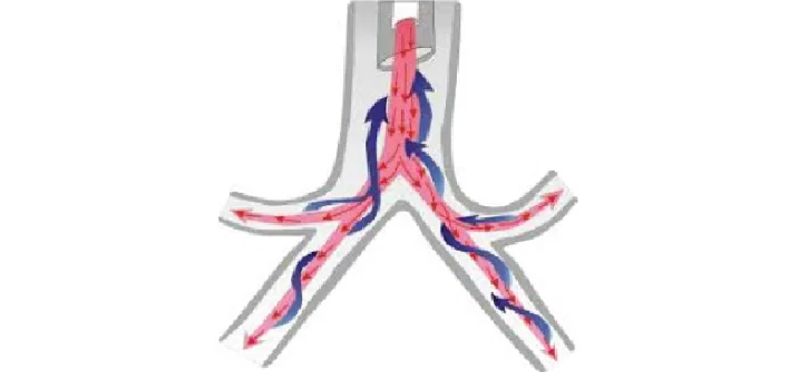 ENDOBRONCHIAL LASER